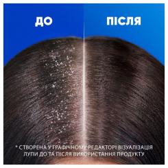 Шампунь Head & Shoulders Глубокое увлажнение 400 мл Фото 3